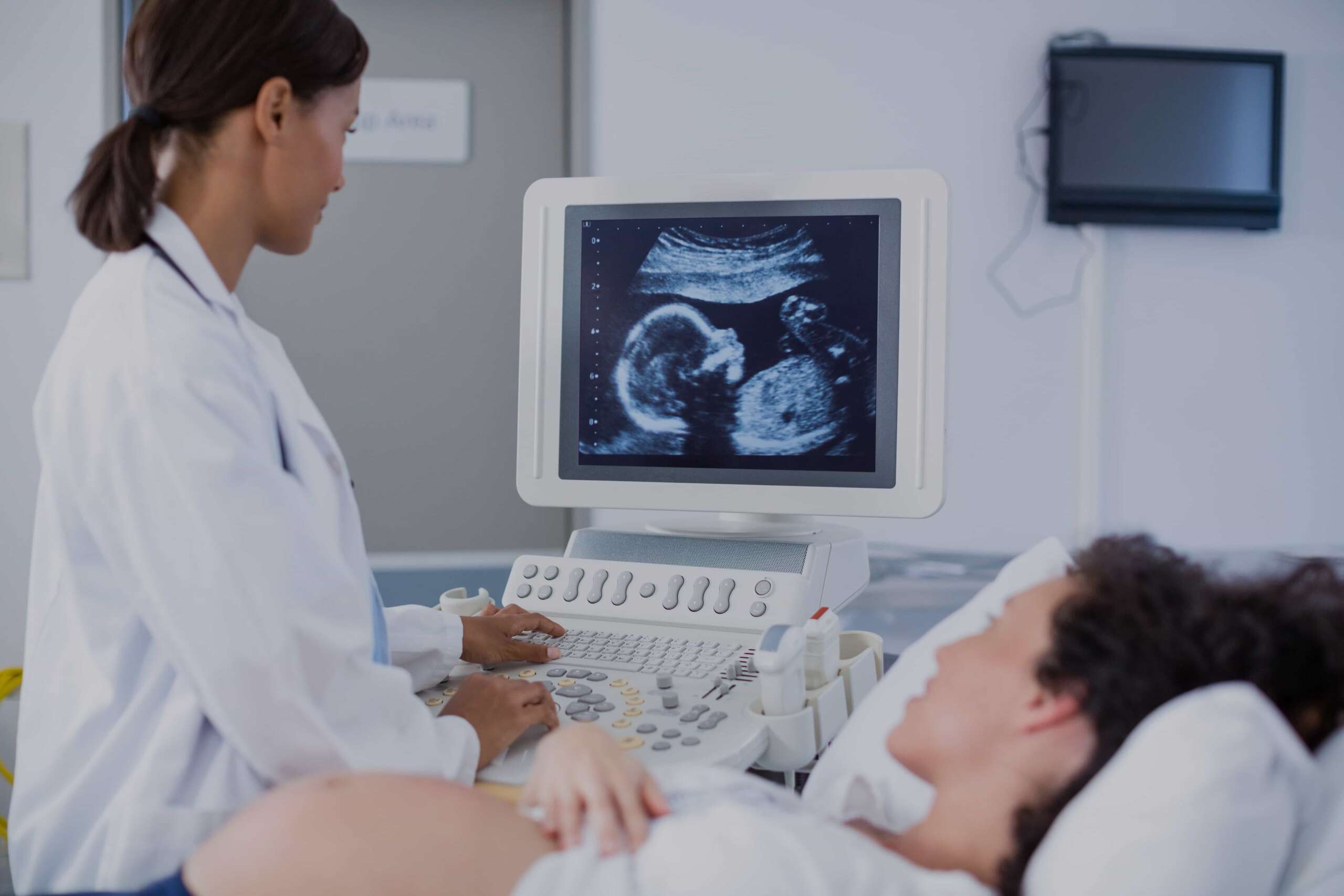 3d 4d Ultrasound – Miami, Florida